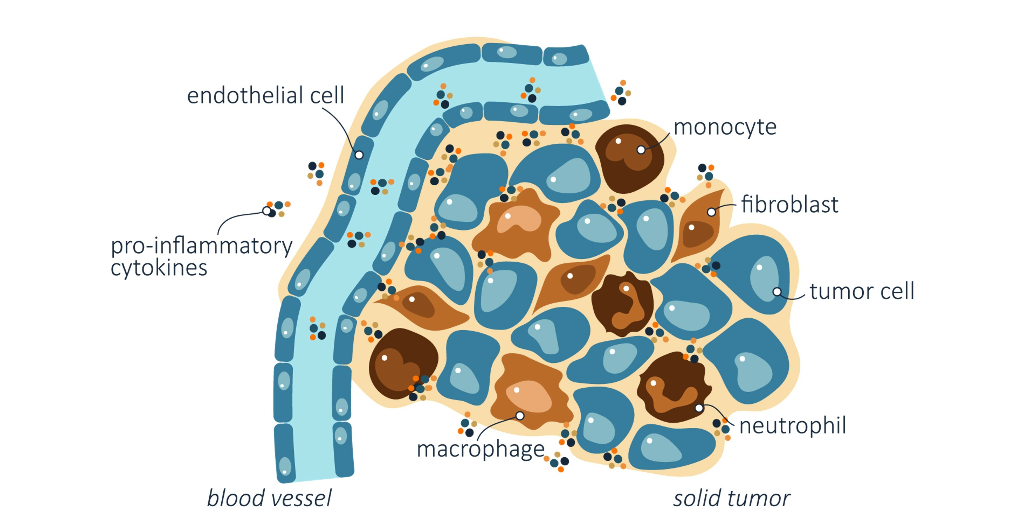 Interleukin-1 in the tumor microenvironment